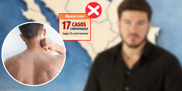 Casos-de-sarampion-vacunacion-masiva-salud-nuevo-leon-alma-rosa-marroquin | Nl Urbano